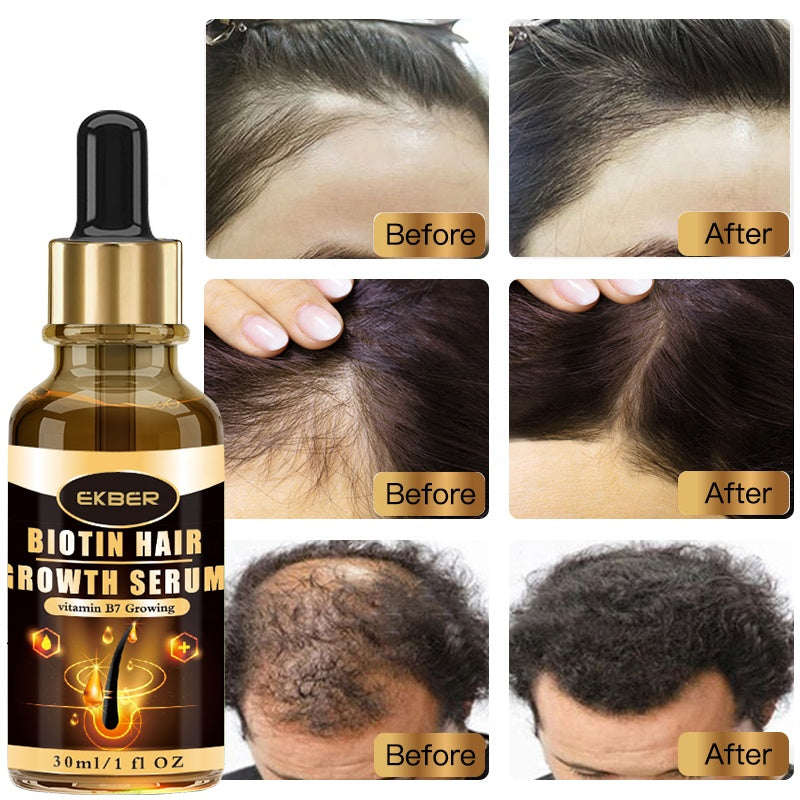 Formula Organic Hair Loss Treatment Hair Growth Biotin Peptide Serum