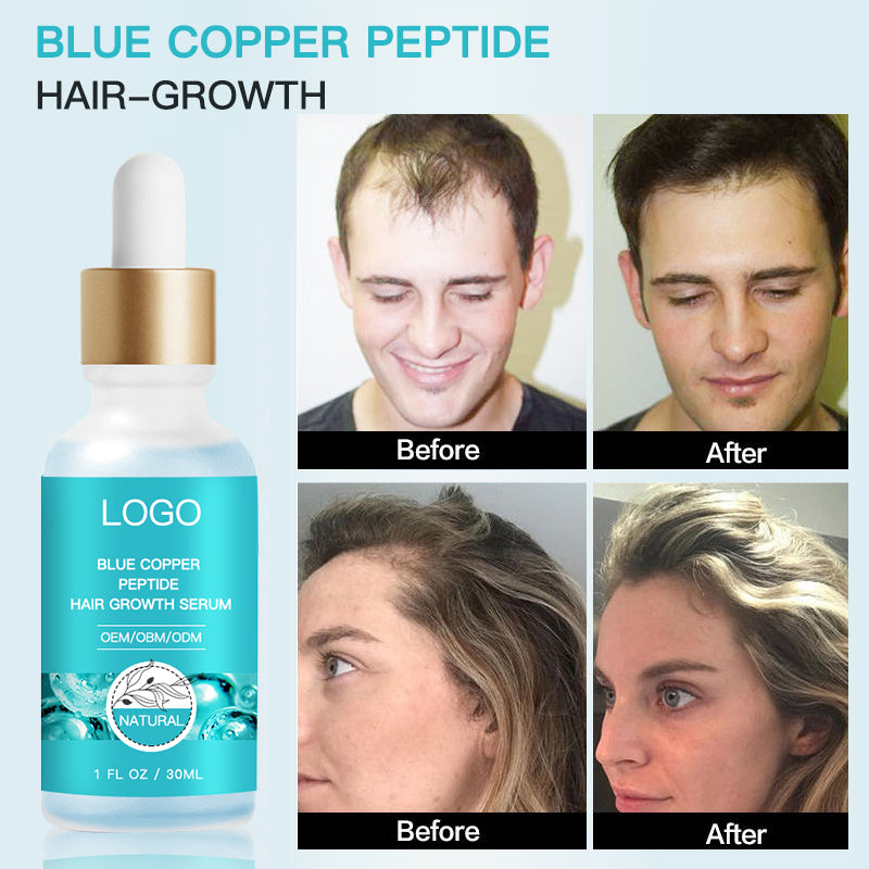Hair Growth Serum Hair Care Line GHK-CU Blue Copper Peptide Hair Growth Serum